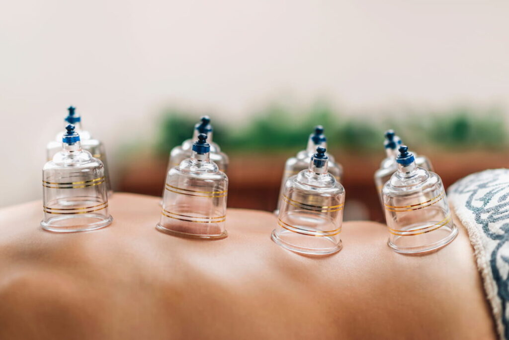 Hijama et le sang noir: quelle signification derrière cette couleur?