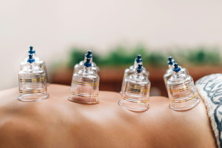 Hijama et le sang noir: quelle signification derrière cette couleur?